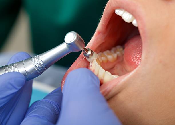 Best Oral Cancer Screening  in USA